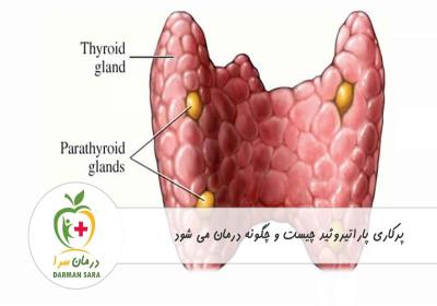 پرکاری پاراتیروئید چیست و چگونه درمان می شود