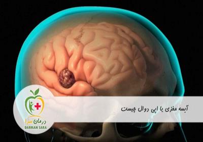 آبسه مغزی یا اپی دوال چیست